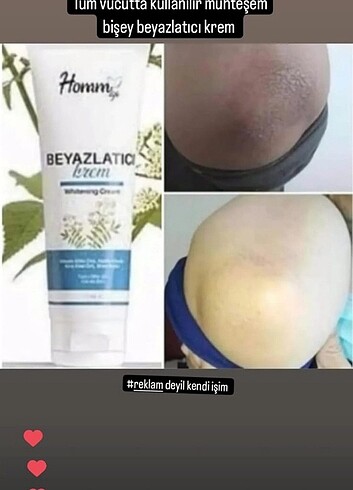 Beyazlatıcı krem 