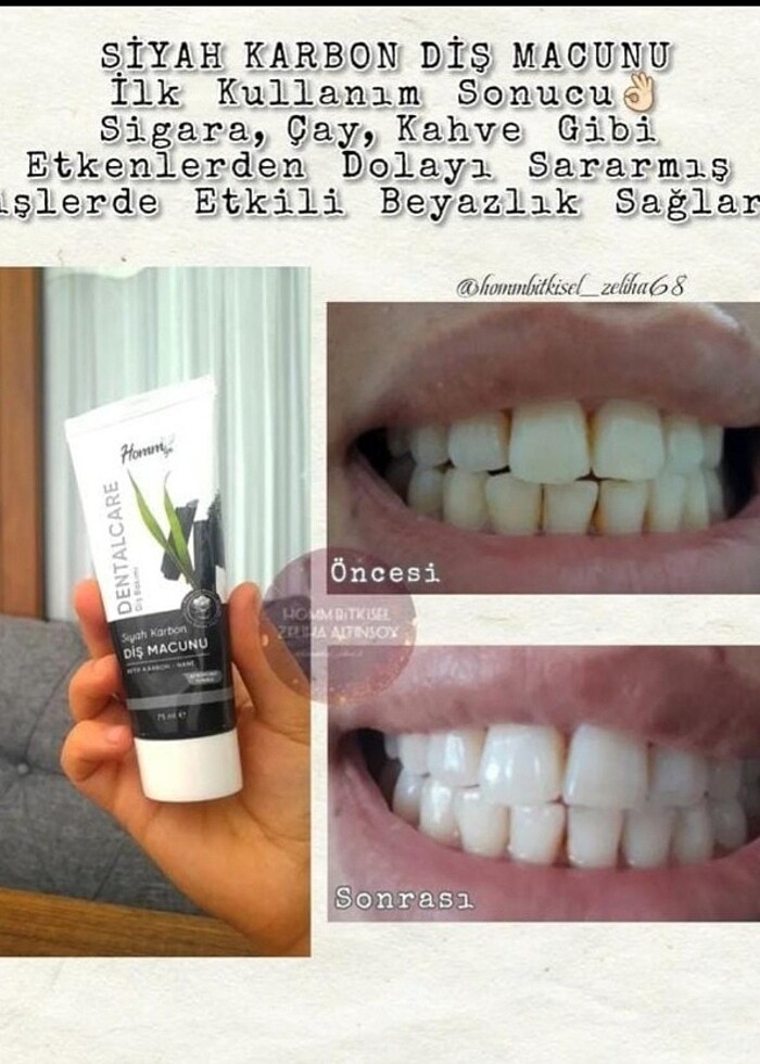 Siyah karbon diş macunu - Görsel 2