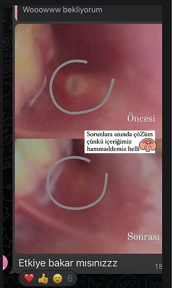  Beden Diş macunu