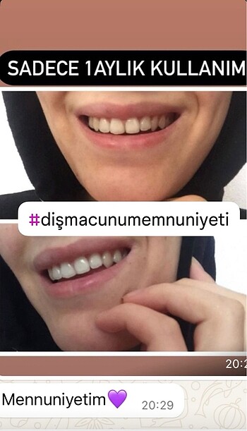 Diğer Diş macunu