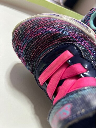 Skechers Skerchers 0 sorun