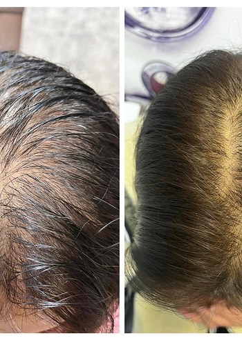 P S Hair Solüsyon Saç Serumu %100 saç çıkartır - Görsel 10