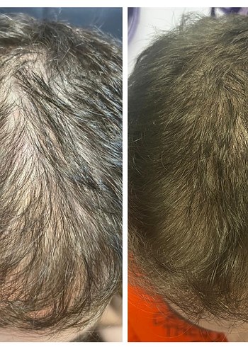 P S Hair Solüsyon Saç Serumu %100 saç çıkartır - Görsel 8