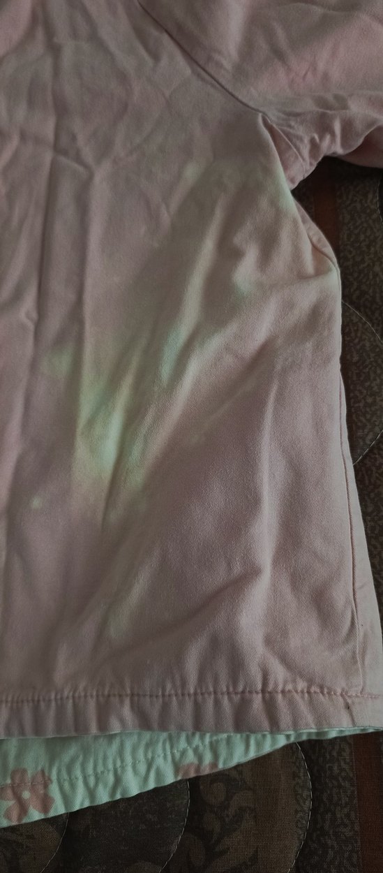 Kapüşonlu Düğmeli Kız Çocuk çift taraflı yağmurluk - Görsel 3