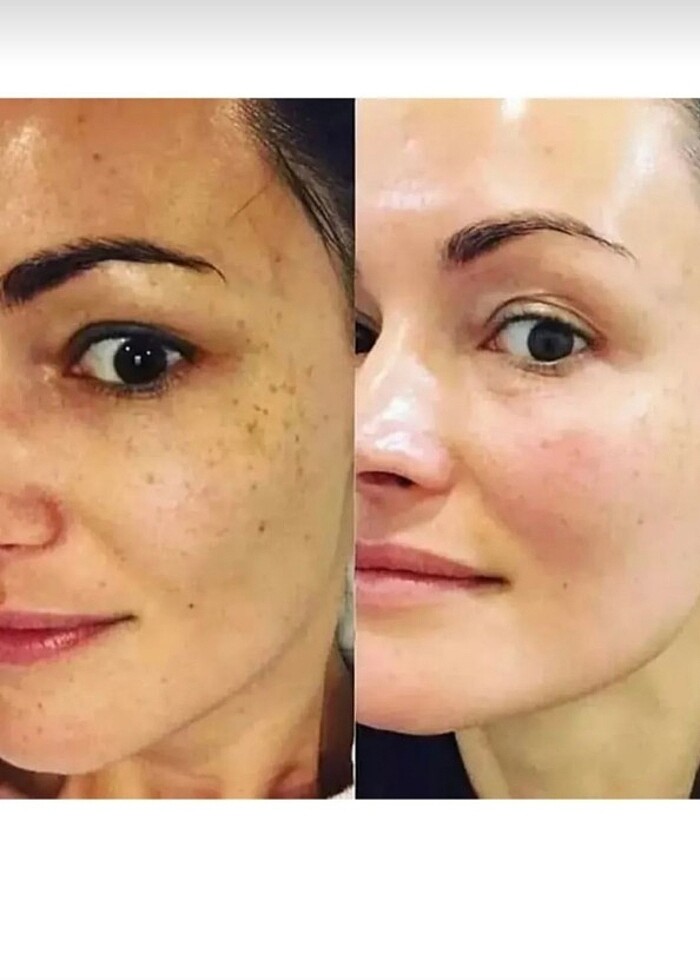 Derma delete soyucu krem - Görsel 4