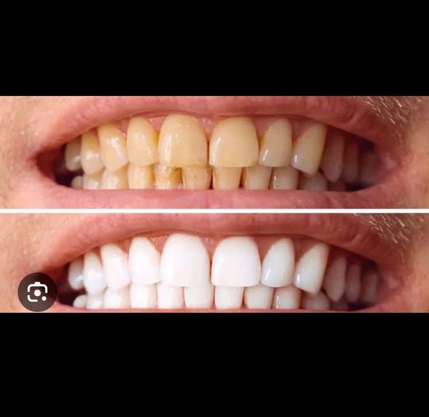 Diş Beyazlatma Süngeri - Görsel 2