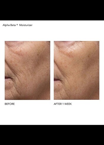 Diğer Dr Dennis Gross Skincare
