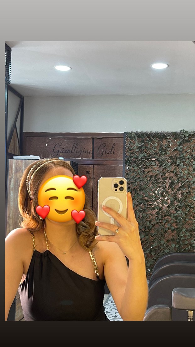 Siyah omuz detaylı elbise - Görsel 2