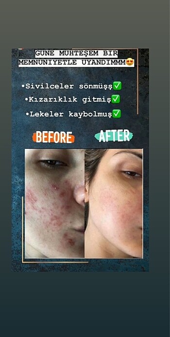 Keçi sütlü sabun