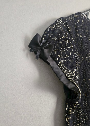 Dantel Detaylı Siyah Sarı Elbise - Görsel 5