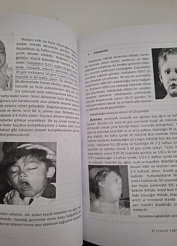 Çocuk sağlığı ve hastalıkları kitabı - Görsel 5