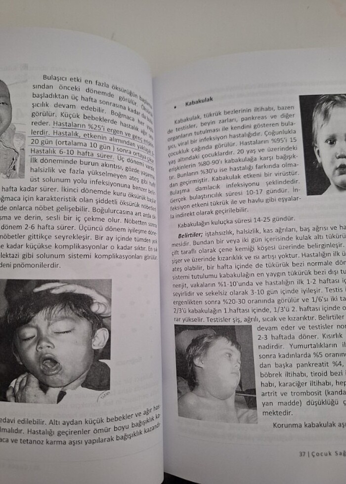 Çocuk sağlığı ve hastalıkları kitabı - Görsel 5