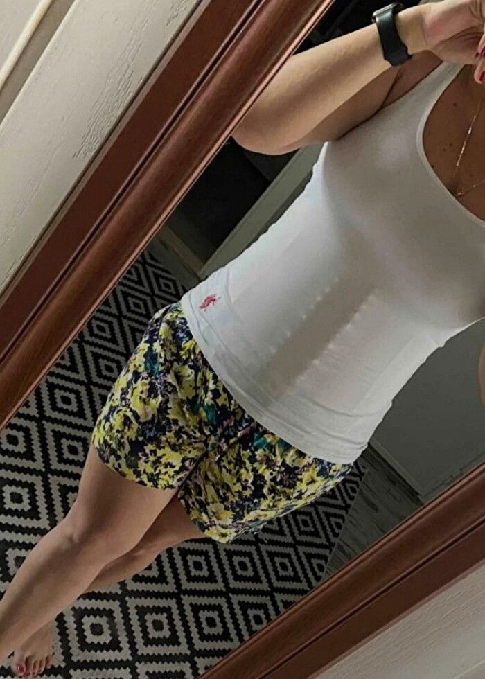 Doğum korsesi - Görsel 2