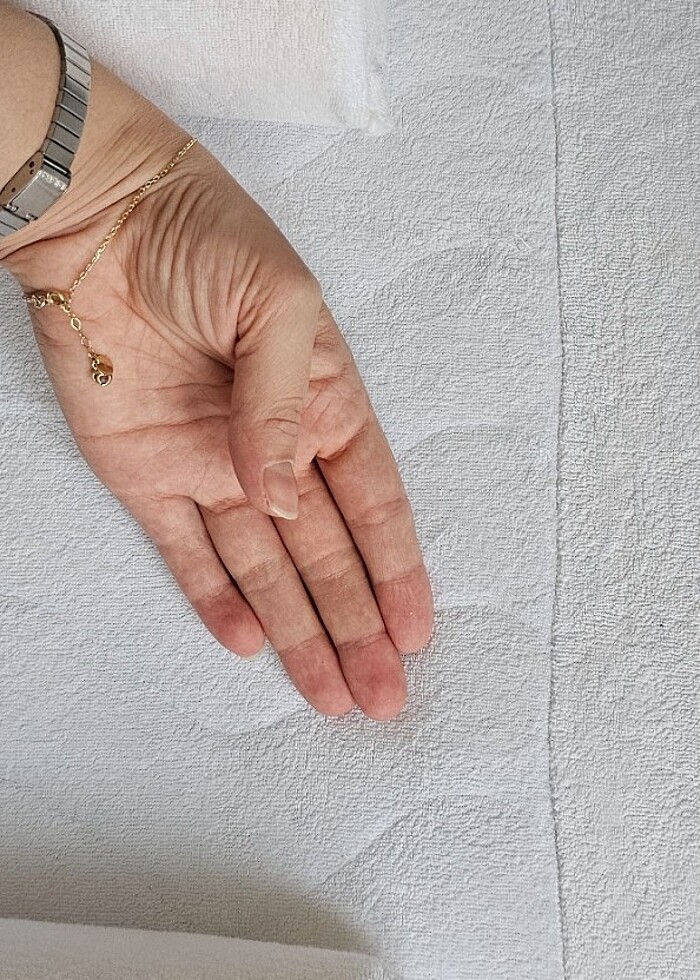 Reflü yatağı - Görsel 5