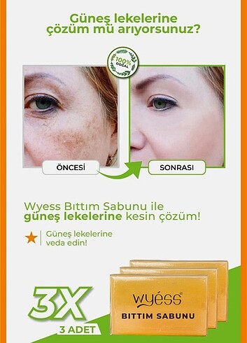 Bıttım sabunu - Görsel 4