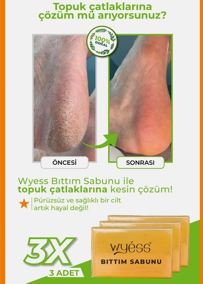 Bıttım sabunu  - Görsel 2