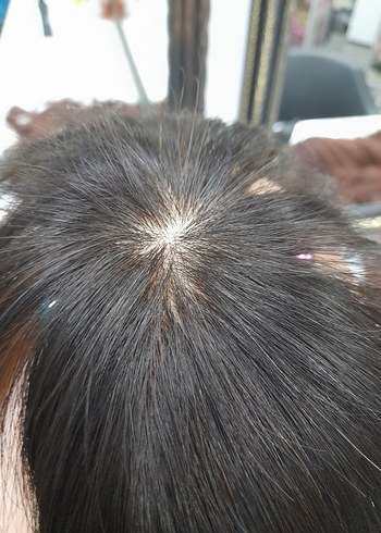 tepelik gerçek Saç Aksesuarı - Görsel 2