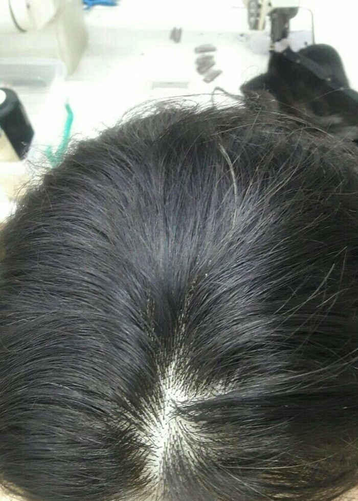 Tülperuk - Görsel 3