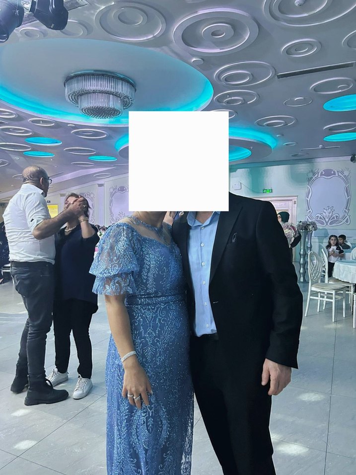 Dantel Detaylı V Yaka Mavi Midi Abiye Elbise - Görsel 5