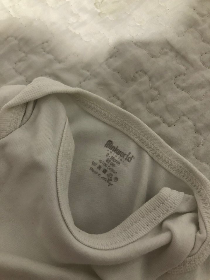 Çıtçıtlı zıbın - Görsel 2