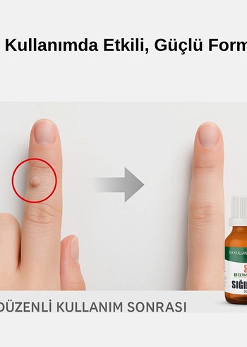 Bizimhekim Siğilsök | Siğil Karsıtı Bitkisel Bakım Solüsyonu - Görsel 8