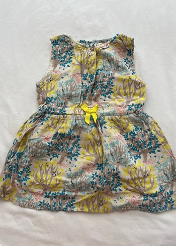 Kız Çocuk Dantelli Elbise - Görsel 4