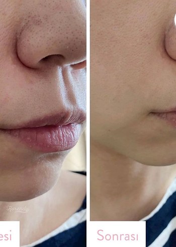 Ma:nyo Pure Temizleyici Yüz Yağı - Görsel 3