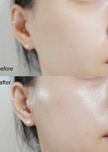 Mediheal Kolajen Elastik Serum x2 - Görsel 8