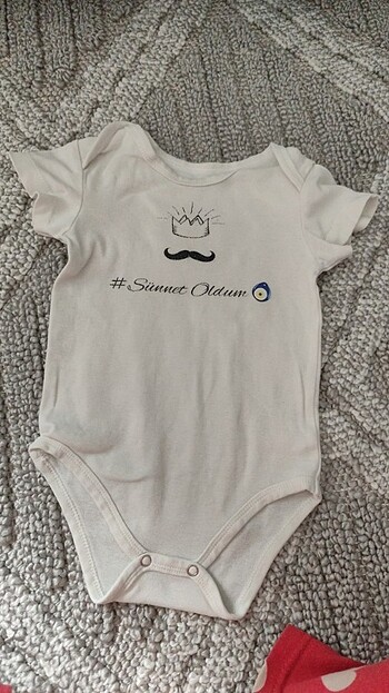 Sünnet badisi bebek