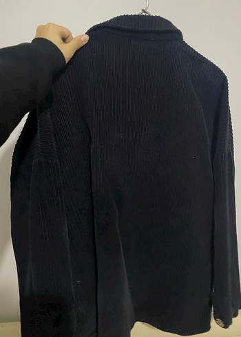 Düğmeli Siyah Ceket - Görsel 2