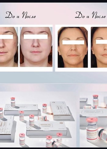 Cilt bakım/ özellikle göz çevresi - Görsel 10