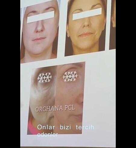 Cilt bakım/ özellikle göz çevresi - Görsel 7