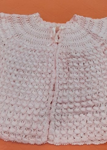 Pembe Örgü Lizöz - Görsel 2