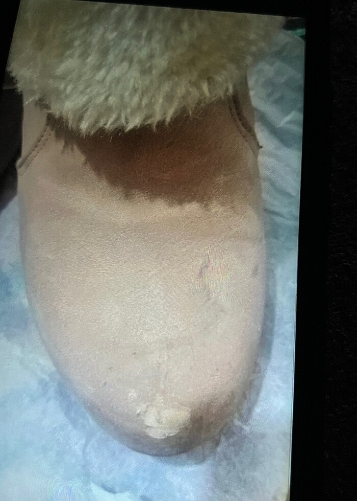 Bot içi yünlü - Görsel 5