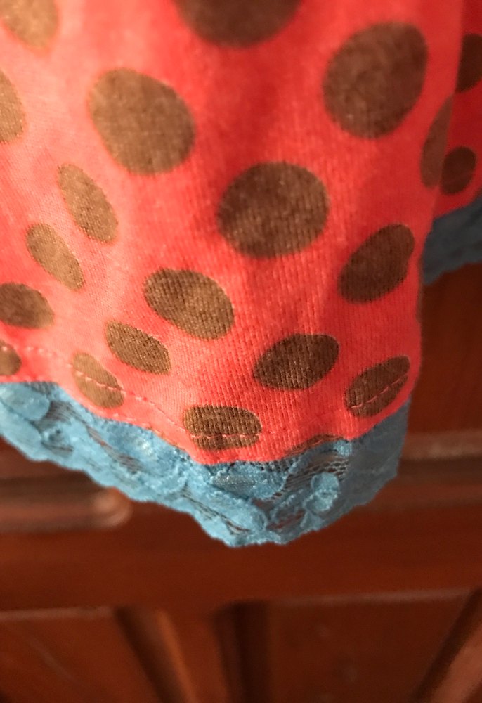 Turunculu desenli eteği dantel Sedef düymeli s beden mini elbise - Görsel 3