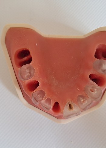 Beden EndoPrep endodontik diş etli çene