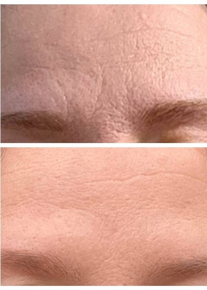 Atomy absolute set  - Görsel 3