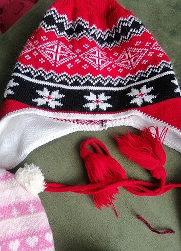 Çocuk bere - Görsel 4