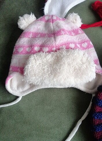 Çocuk bere - Görsel 5