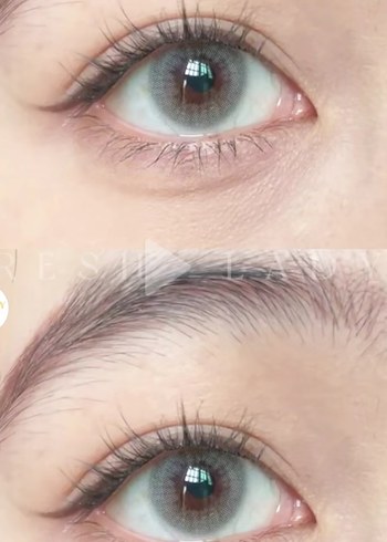 yıllık - Görsel 2