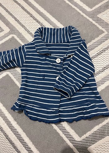 Düğmeli Lacivert Çizgili Kız Çocuk Ceketi - Görsel 2