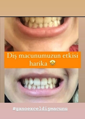 Diğer Gani Excel diş macunu?