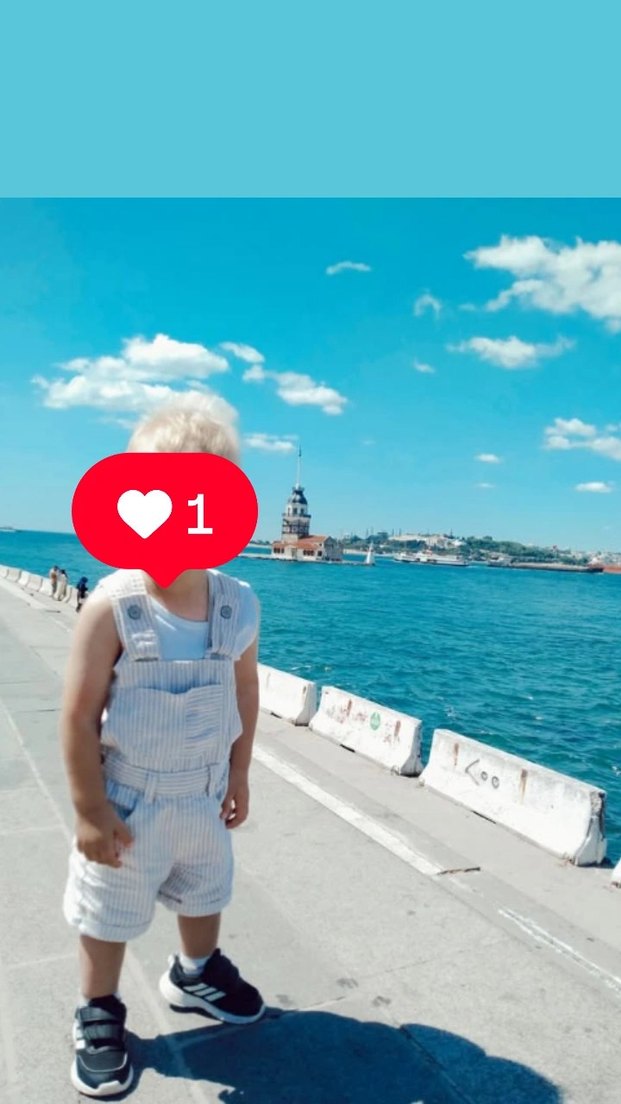 Çizgili Erkek Çocuk Salopet - Görsel 3