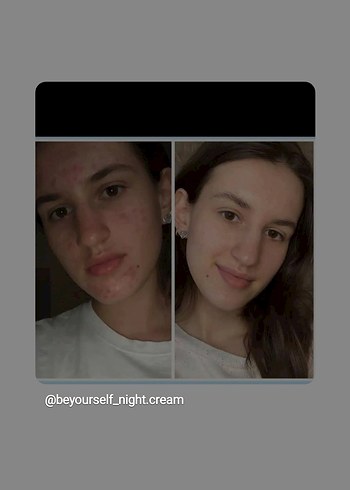 Be Yourself güzellik kremi - Görsel 3