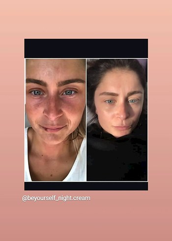 Be Yourself güzellik kremi - Görsel 5