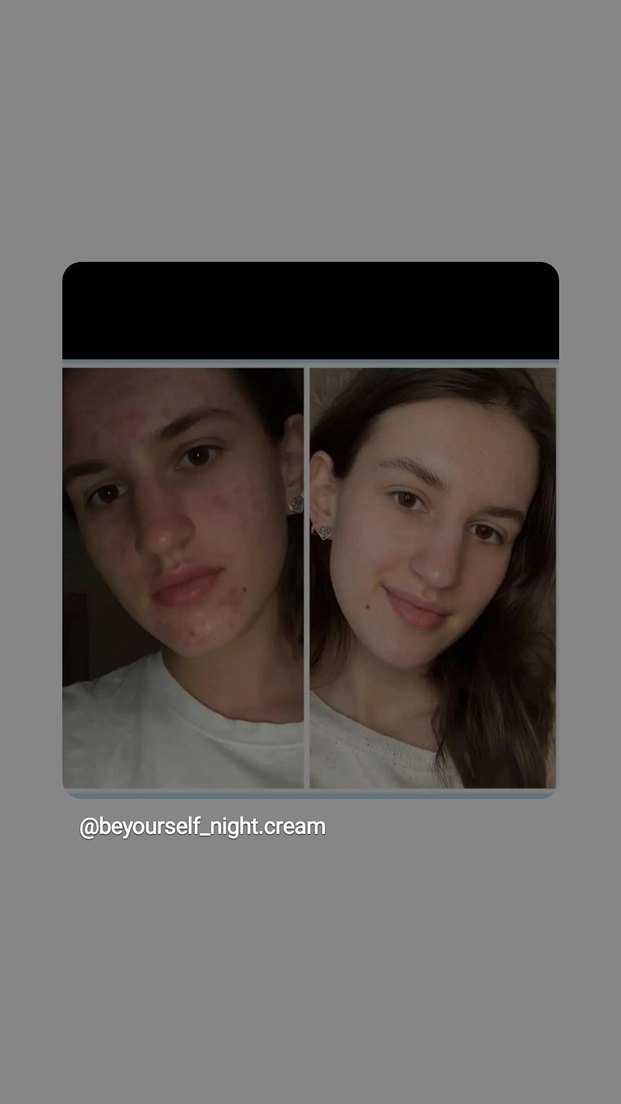 Be Yourself güzellik kremi - Görsel 3