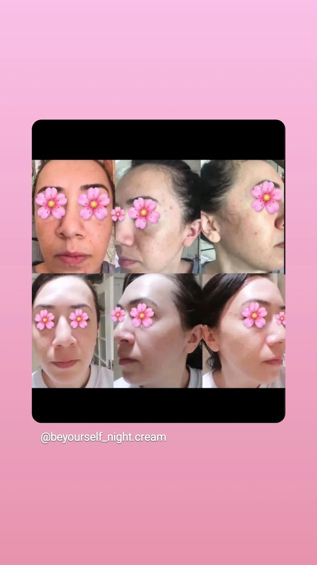 Be Yourself güzellik kremi - Görsel 4