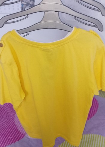 Sarı Düğmeli Erkek çocuk Tişört - Görsel 3