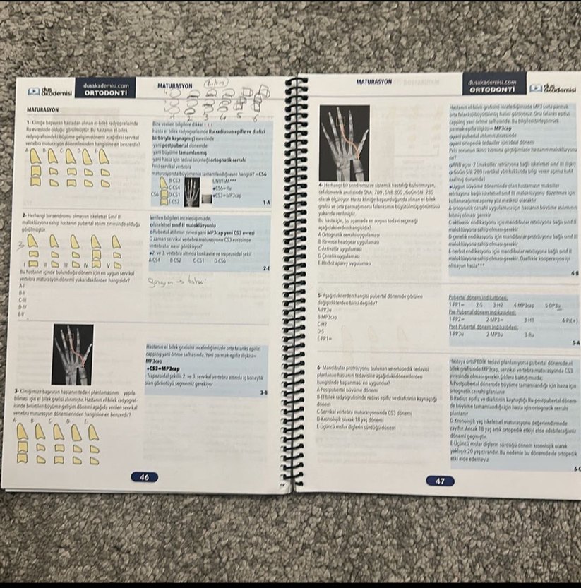 Dusakademi Ortodonti Hızlı Tekrar Soru Bankası - Zehra Akın - Görsel 2