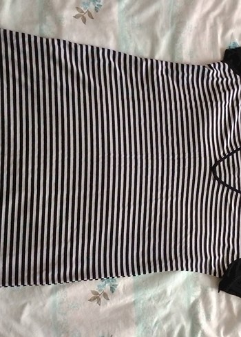 Dantel Detaylı Siyah Gri Çizgili Mini Elbise - Görsel 2